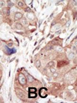 VEGFR2 (FLK1/KDR) Antibody (C-term)