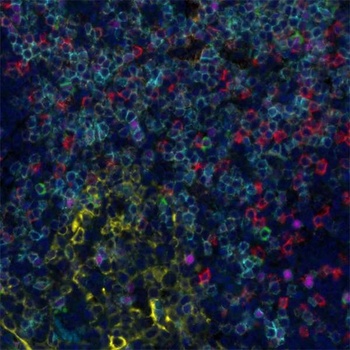 T Cell Status PathPlex Panel