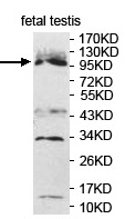ERMP1 Rabbit Polyclonal Antibody