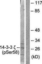 14-3-3 ζ (Phospho-Ser58) Antibody