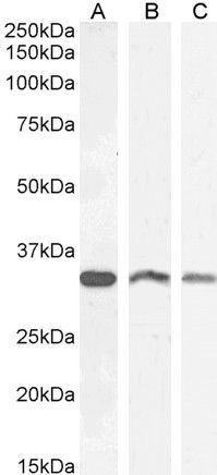VDAC2 (C Terminus) Antibody
