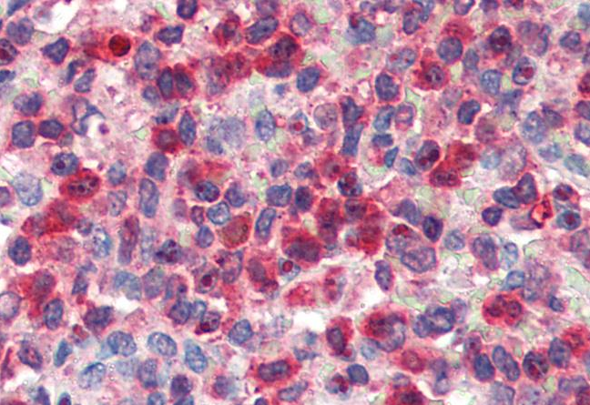 G6PD (aa 308 - 320) Antibody