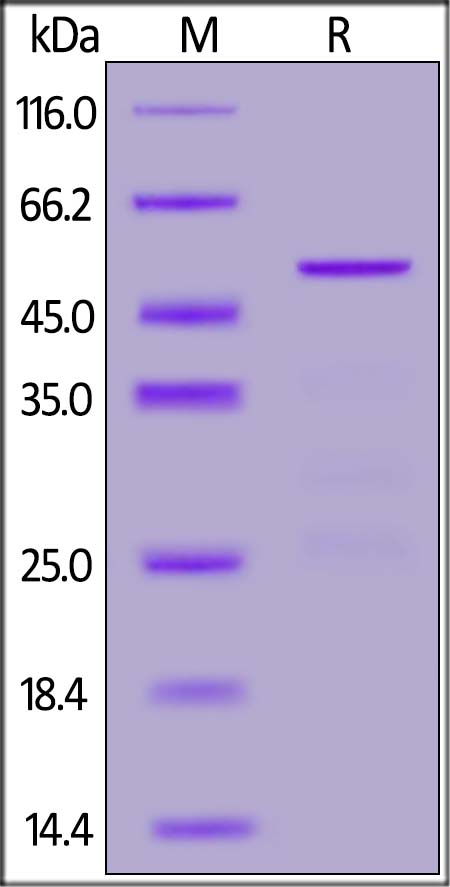 SARS-CoV-2 (COVID-19) Nucleocapsid Protein, His Tag