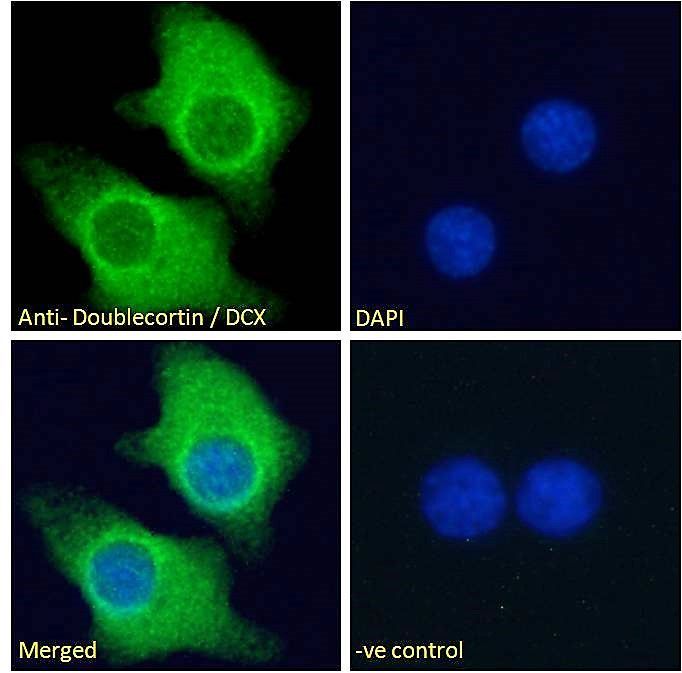 Doublecortin/DCX (aa232-242) Antibody