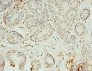 TMEM45A Antibody