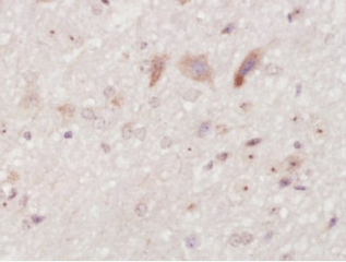 NARC1/PCSK9 Rabbit Polyclonal Antibody (FITC)
