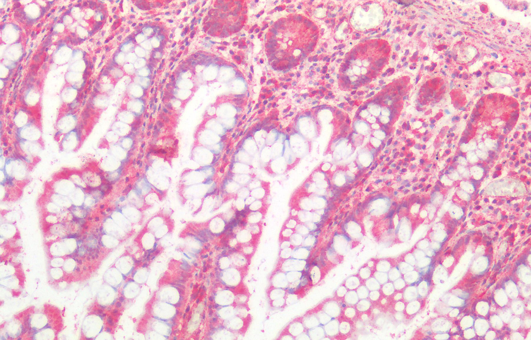 Cathepsin B Antibody