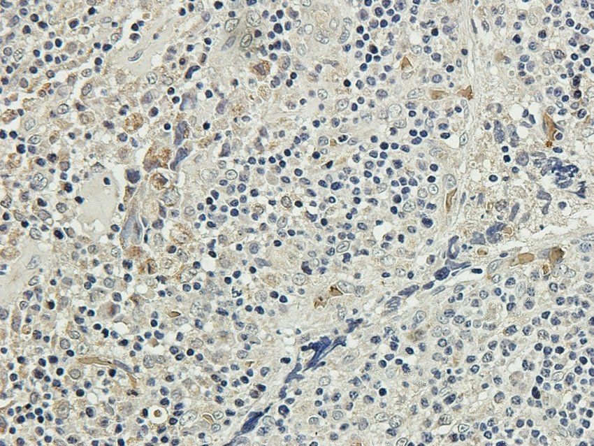 GGT1 (Isoform 1-7) antibody