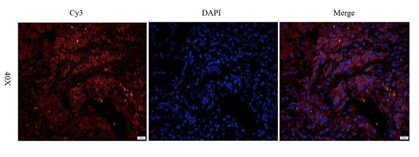 GGT1 (Isoform 1-7) antibody