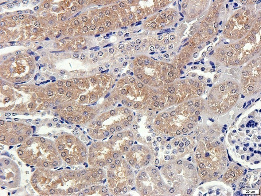 TACD2 Rabbit Polyclonal Antibody