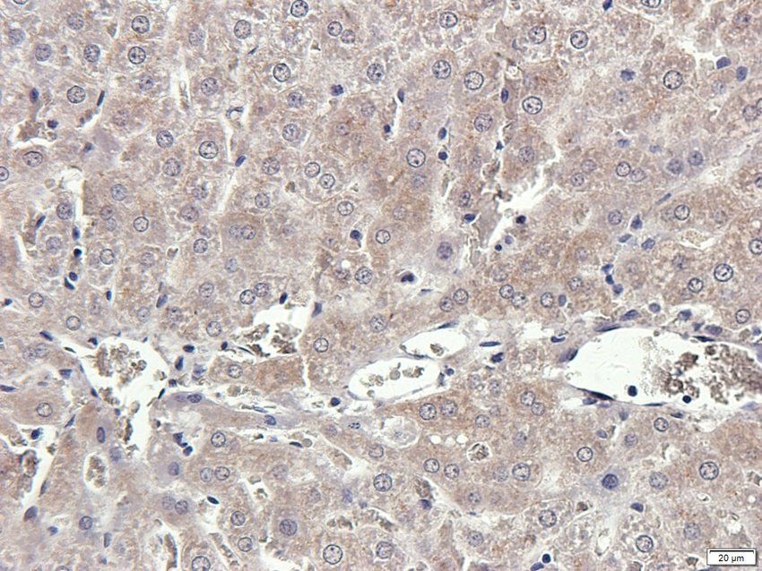 TACD2 Rabbit Polyclonal Antibody