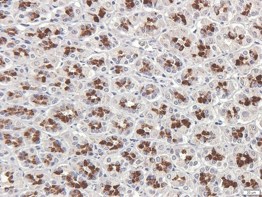 TACD2 Rabbit Polyclonal Antibody