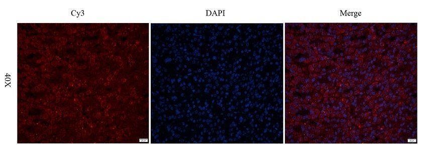 TACD2 Rabbit Polyclonal Antibody