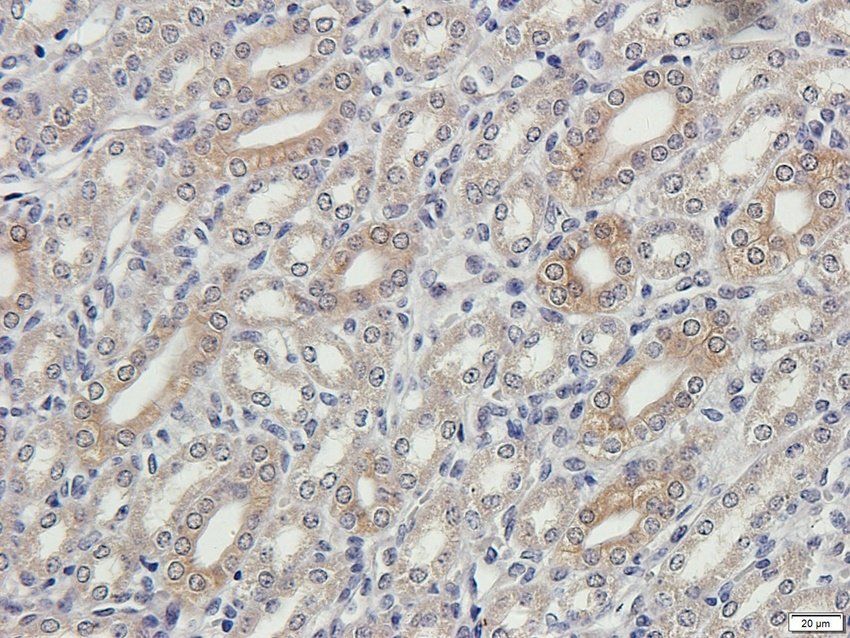 INHBE Rabbit Polyclonal Antibody