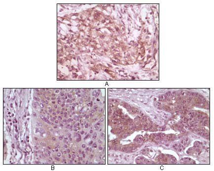 4E-BP1 Antibody