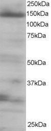 4E-T/EIF4ENIF1 Antibody
