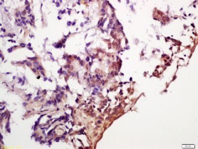 Phospho-eIF4EBP1 (Ser65 + Thr70) Rabbit Polyclonal Antibody