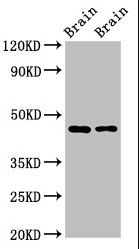 SOX11 Antibody
