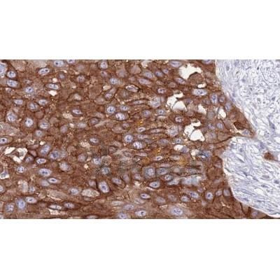 CD3 zeta Antibody