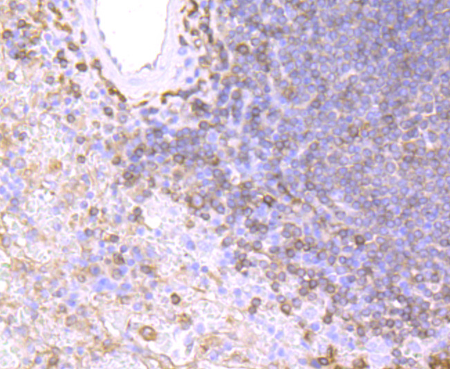 HLA-DPB1 polyclonal antibody