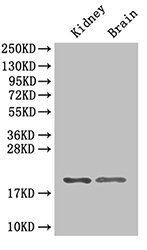 RPL11 Antibody