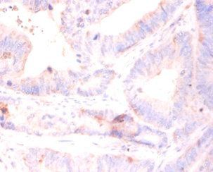 RPL5 Antibody