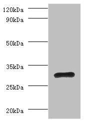 RPL5 Antibody