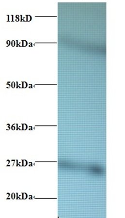 RPL17 Antibody (Biotin)