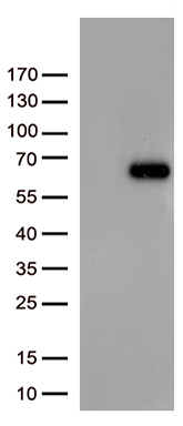 67kDa Laminin Receptor Antibody