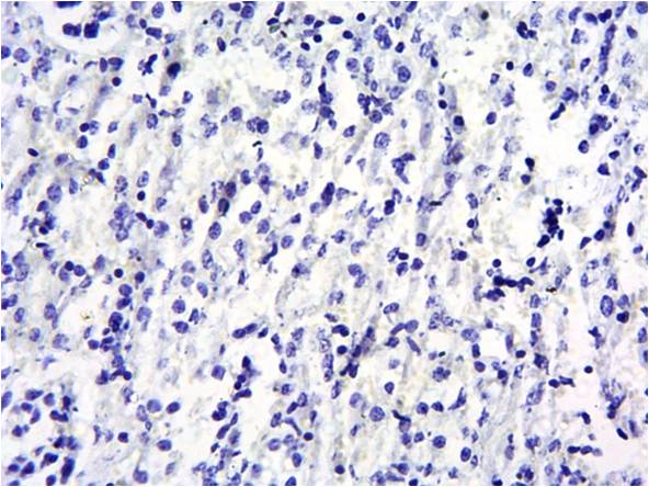 SOCS1 Antibody