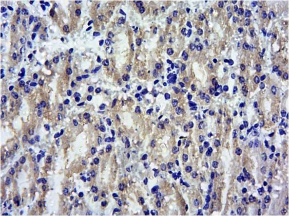 SOCS1 Antibody
