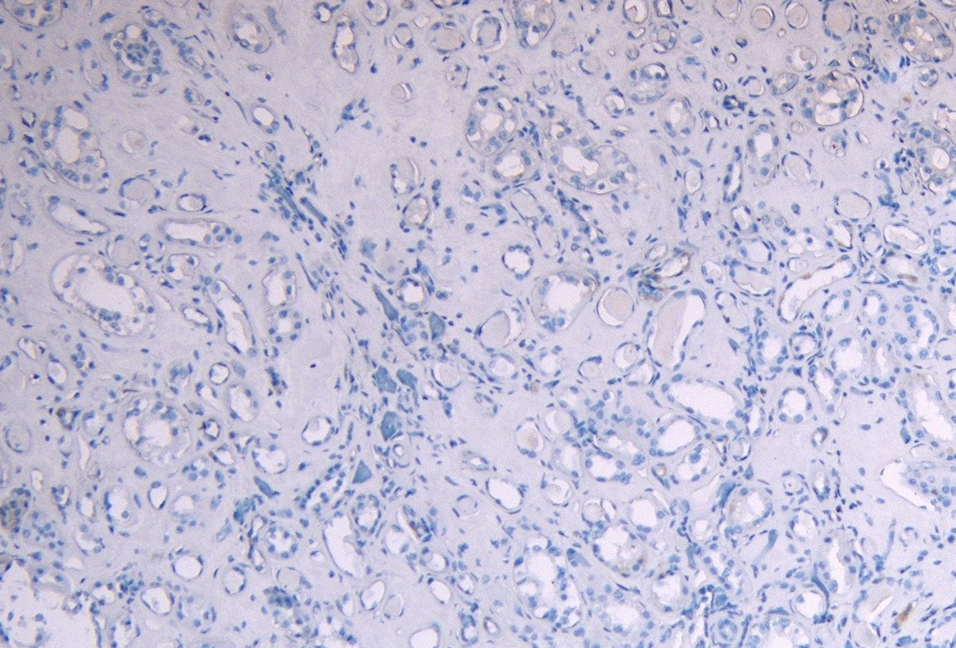 SOCS1 Antibody