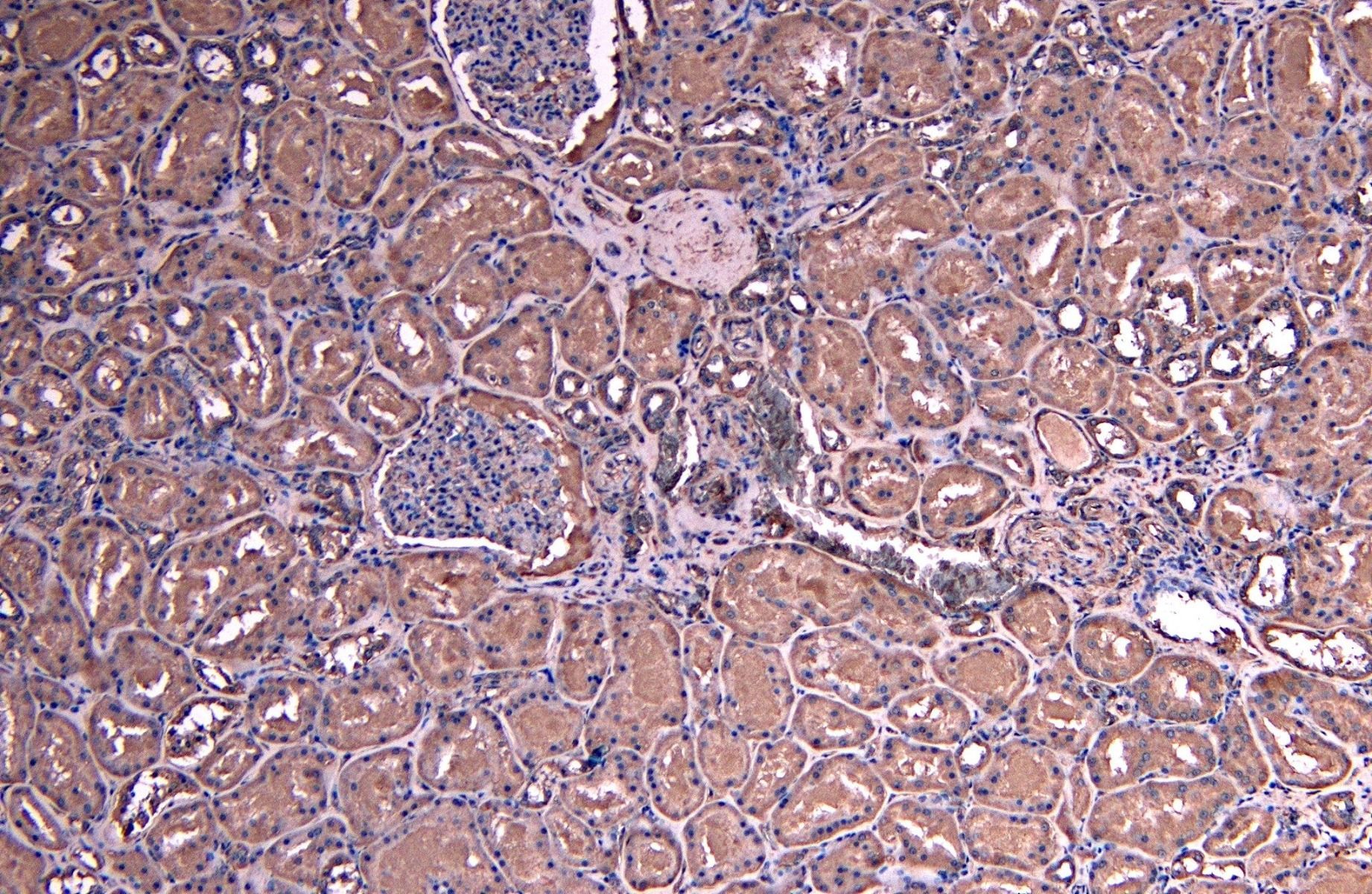 SOCS1 Antibody