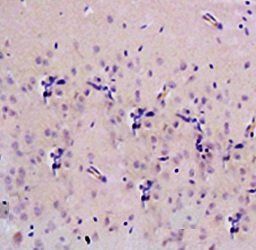 8-OHdG (DNA/RNA Damage) Rabbit Polyclonal Antibody