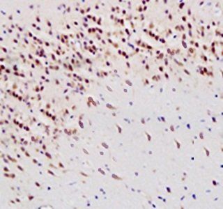 8-OHdG (DNA/RNA Damage) Rabbit Polyclonal Antibody