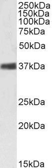 Nucleophosmin/NPM1 Antibody