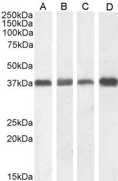Nucleophosmin/NPM1 Antibody