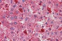 Hamartin/TSC1 (isoform 1) Antibody