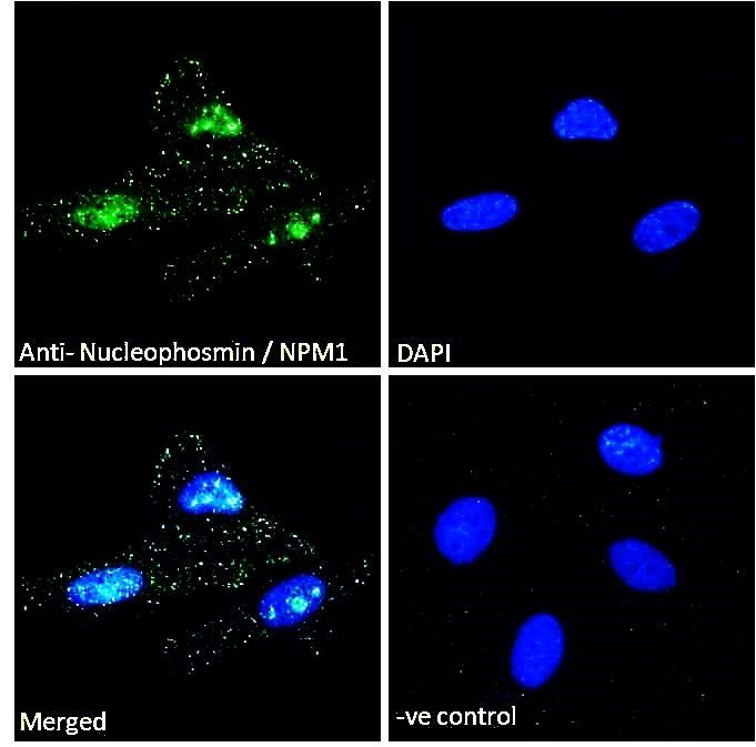 Nucleophosmin/NPM1 Antibody