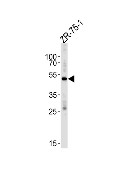 AGTR1 Antibody (C-term Y319)