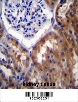 PR15B Antibody (C-term)