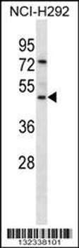 GP2 Antibody (N-term)