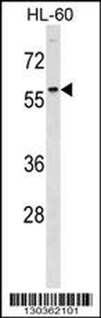 DCDC2 Antibody (Center)