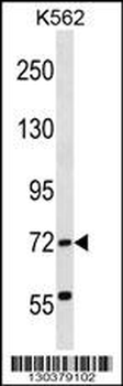 ABCF2 Antibody (N-term)