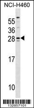 SH3BGR Antibody (Center)