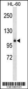 GPLD1 Antibody (Center)