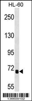 IL1RAPL2 Antibody (Center)