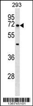 NR5A2 Antibody (Center)