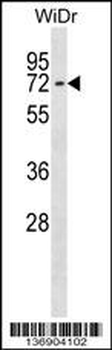CTNNBL1 Antibody (N-term)