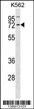 CCNK Antibody (N-term)